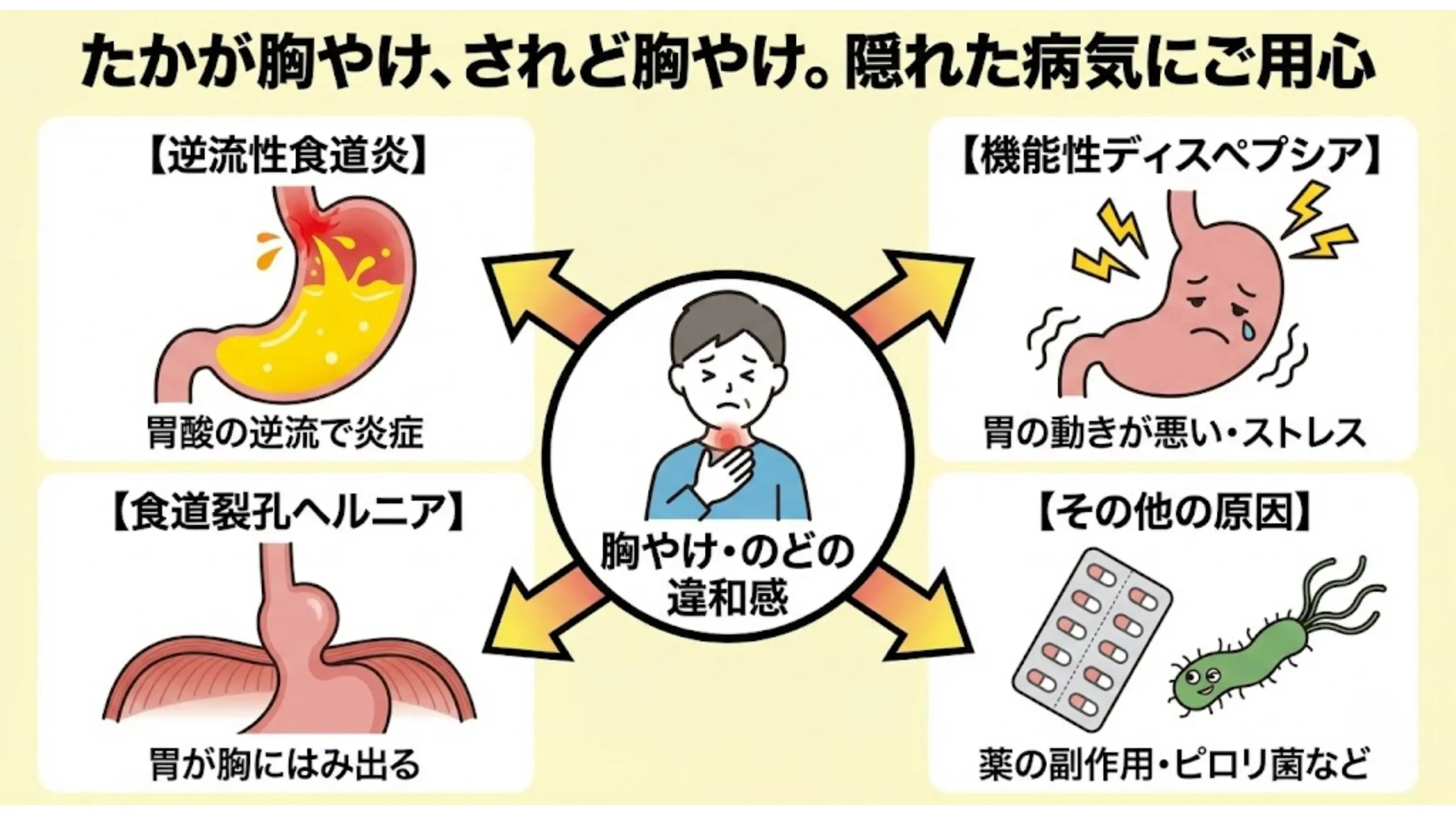 胸やけ｜逆流性食道炎・胃の不調と受診の目安｜おなかのクリニック紬